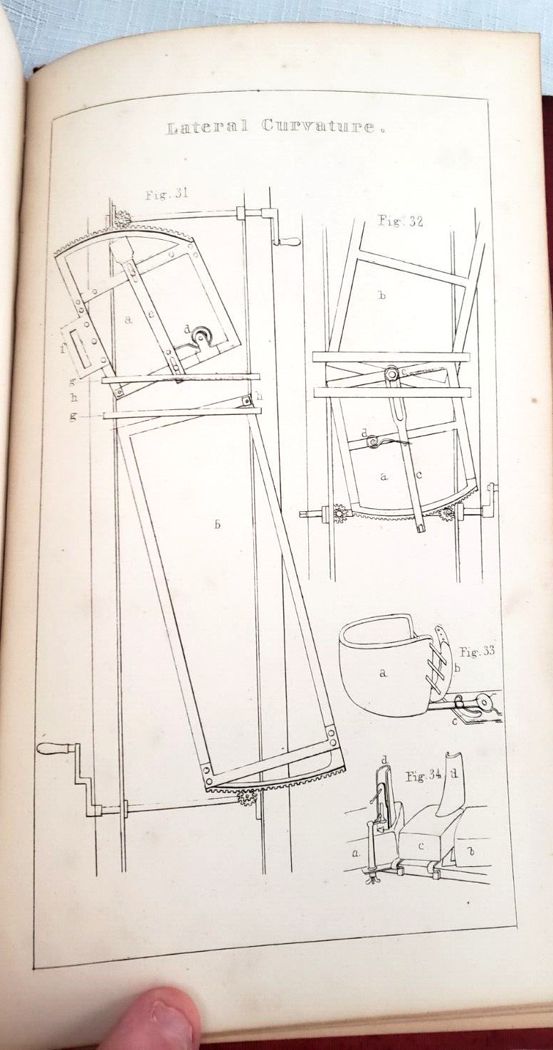 1845 1st,Bigelow MANUAL OF ORTHOPEDIC SURGERY,Harvard Medical Prize, MANY PLATES