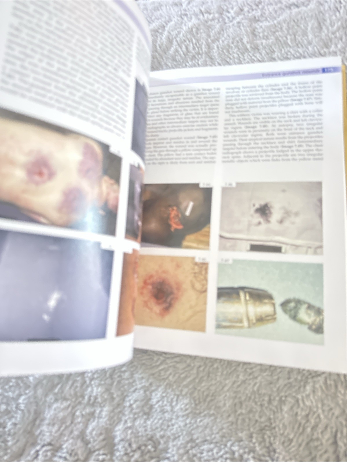 Forensic Pathology Principles and Practice Dolinak Matshes Lew Hardcover HC