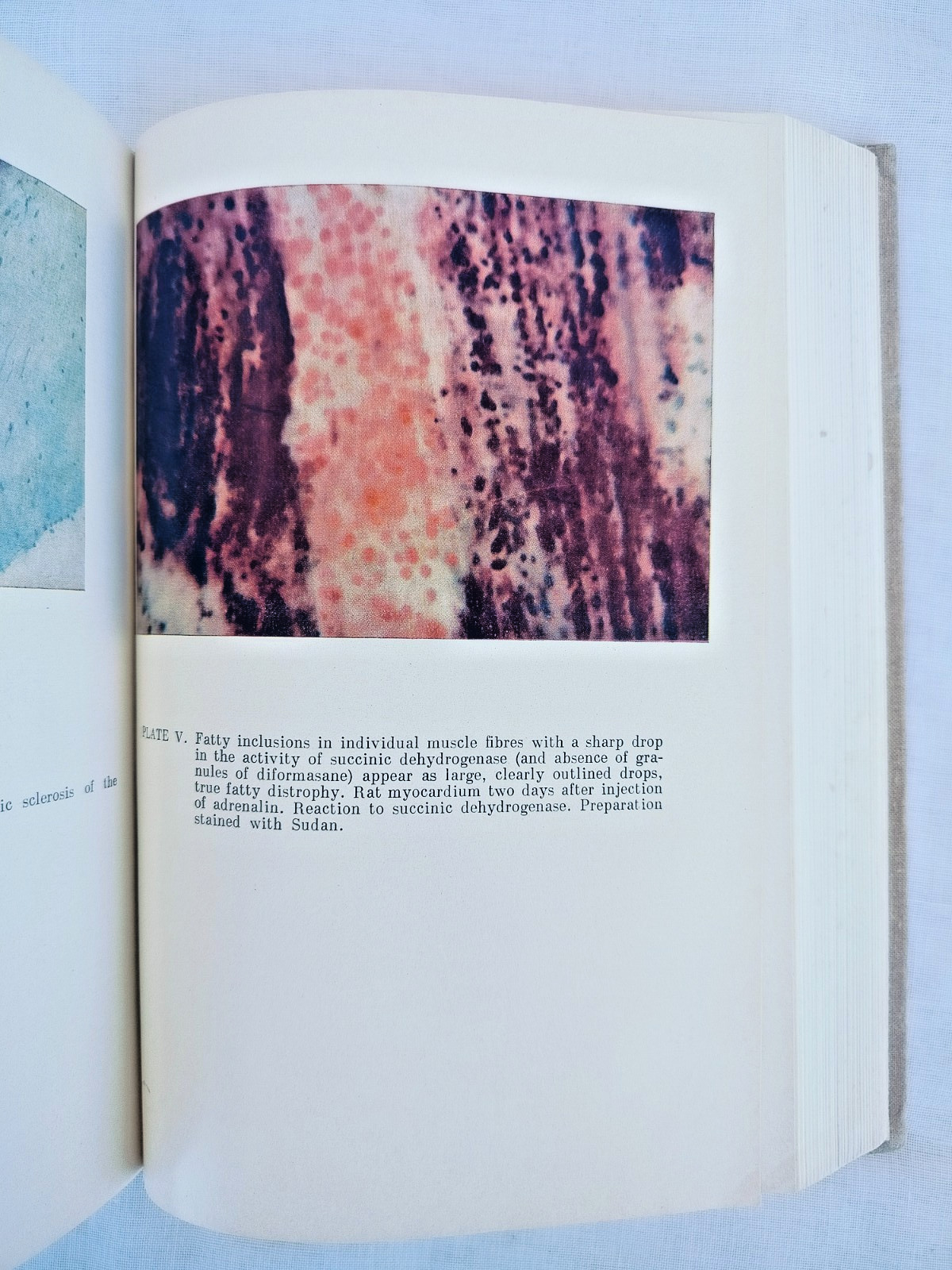 General Human Pathology by Ippolit Davydovsky, Mir Publishers, 1971, Hardcover