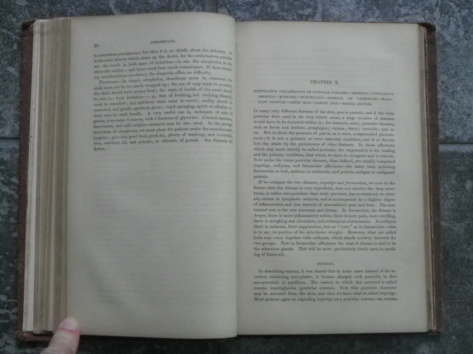 Skin Diseases-Description Pathology Diagnosis Treatment-Fox-1871-1st US Ed-Rare