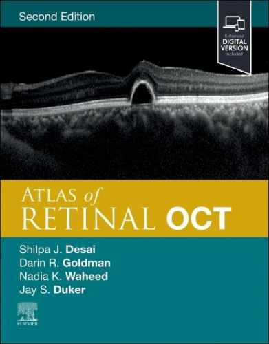 Atlas of Retinal OCT: Optical – Hardcover, by Duker MD Jay – Very Good b