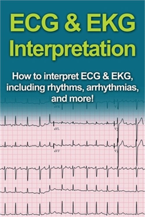ECG & EKG Interpretation: How to interpret ECG & EKG, including rhythms, arrhyth