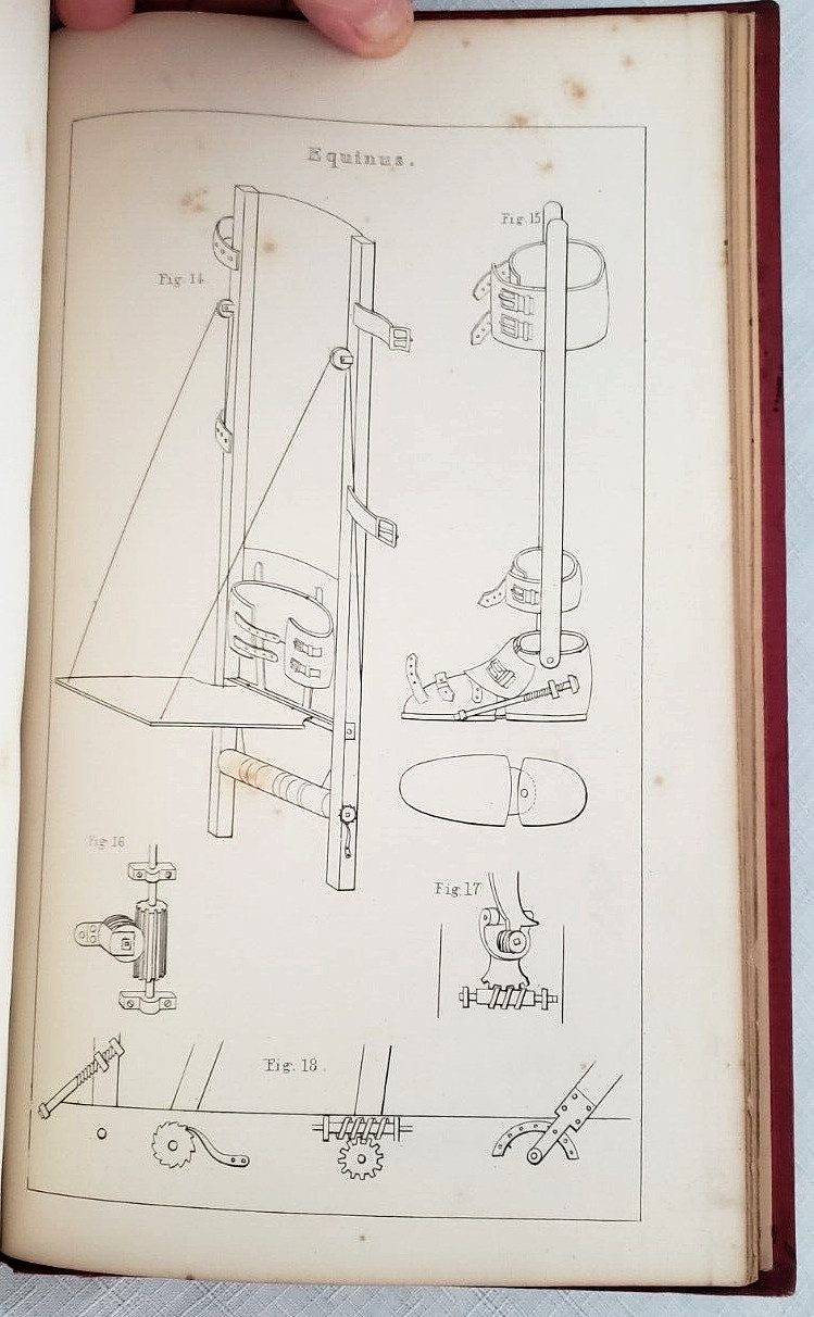 1845 1st,Bigelow MANUAL OF ORTHOPEDIC SURGERY,Harvard Medical Prize, MANY PLATES