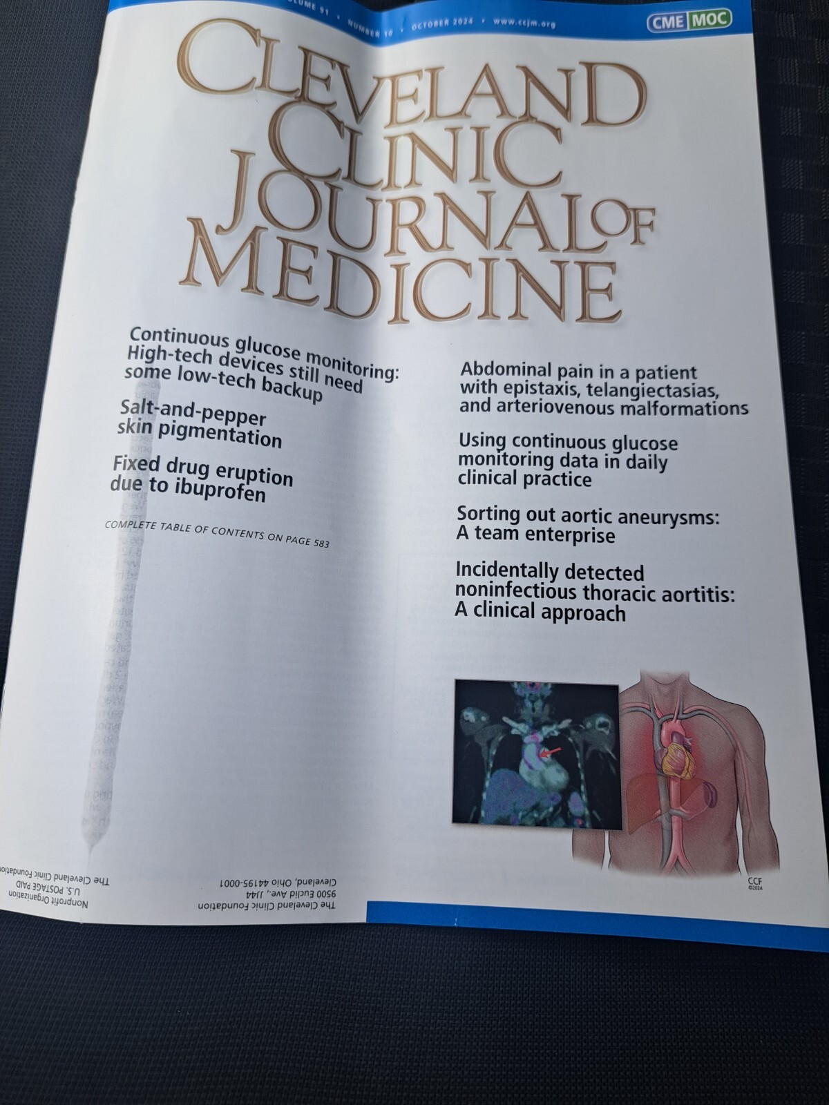 Cleveland Clinic Journal of Medicine Magazine October 2024 Glucose, Thoracic