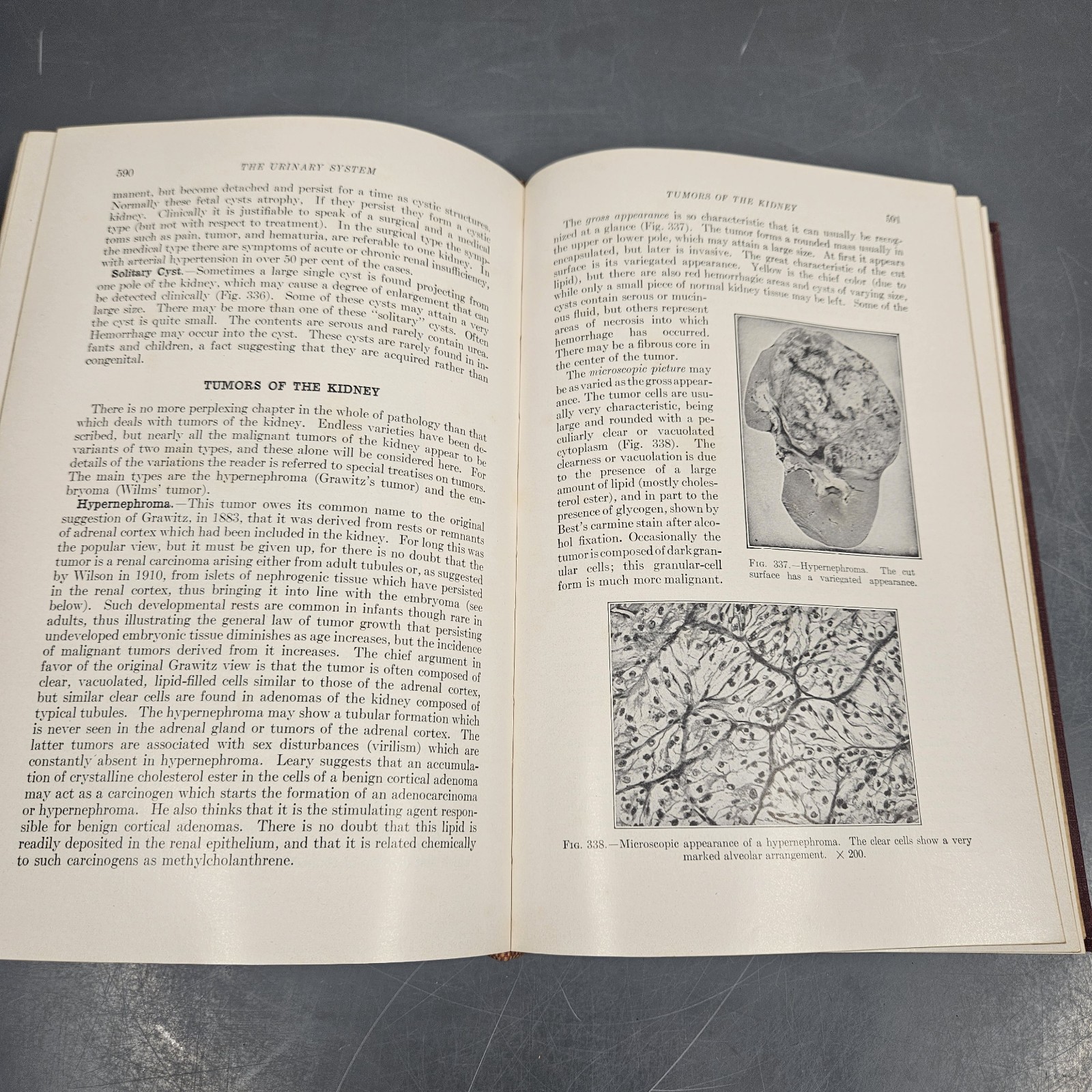 1955 A Textbook Of Pathology An Introduction To Medicine W. Boyd 6th Edition