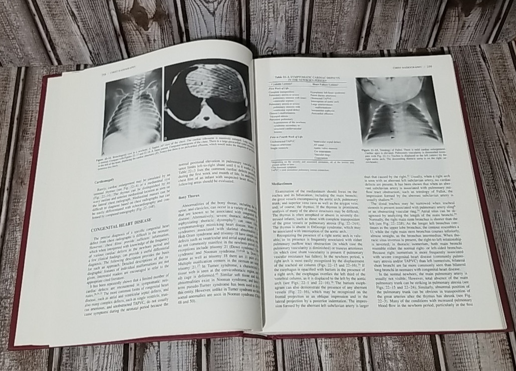 Fetal & Neonatal Cardiology Walker A. Long MD Hardback Hardcover 1990 Ships Fast