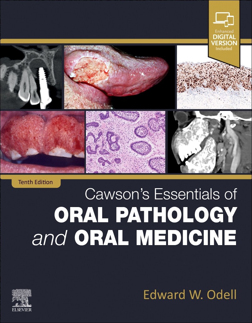Cawson&rsquo;s Essentials of Oral Pathology and Oral Medicine
