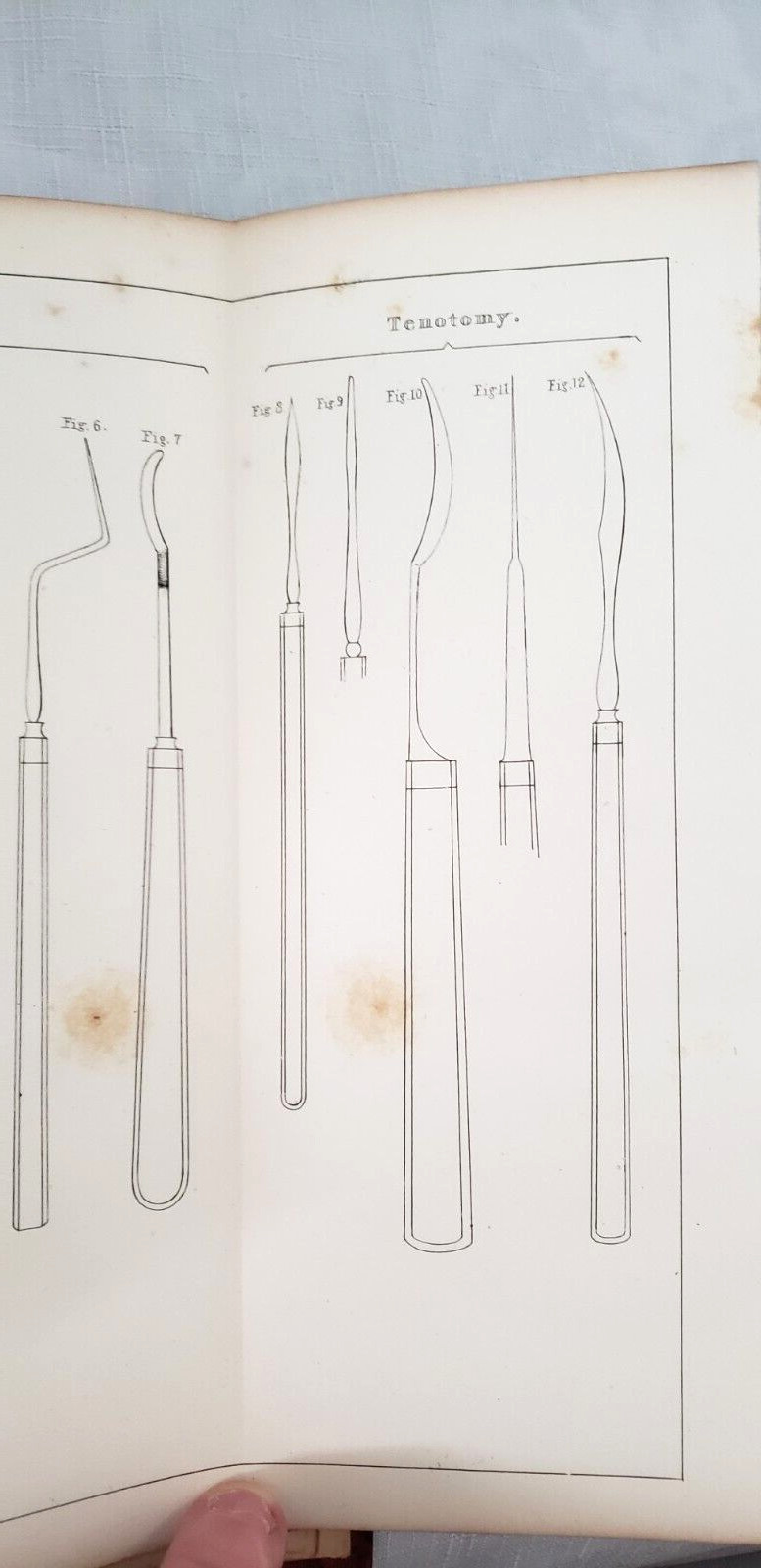 1845 1st,Bigelow MANUAL OF ORTHOPEDIC SURGERY,Harvard Medical Prize, MANY PLATES