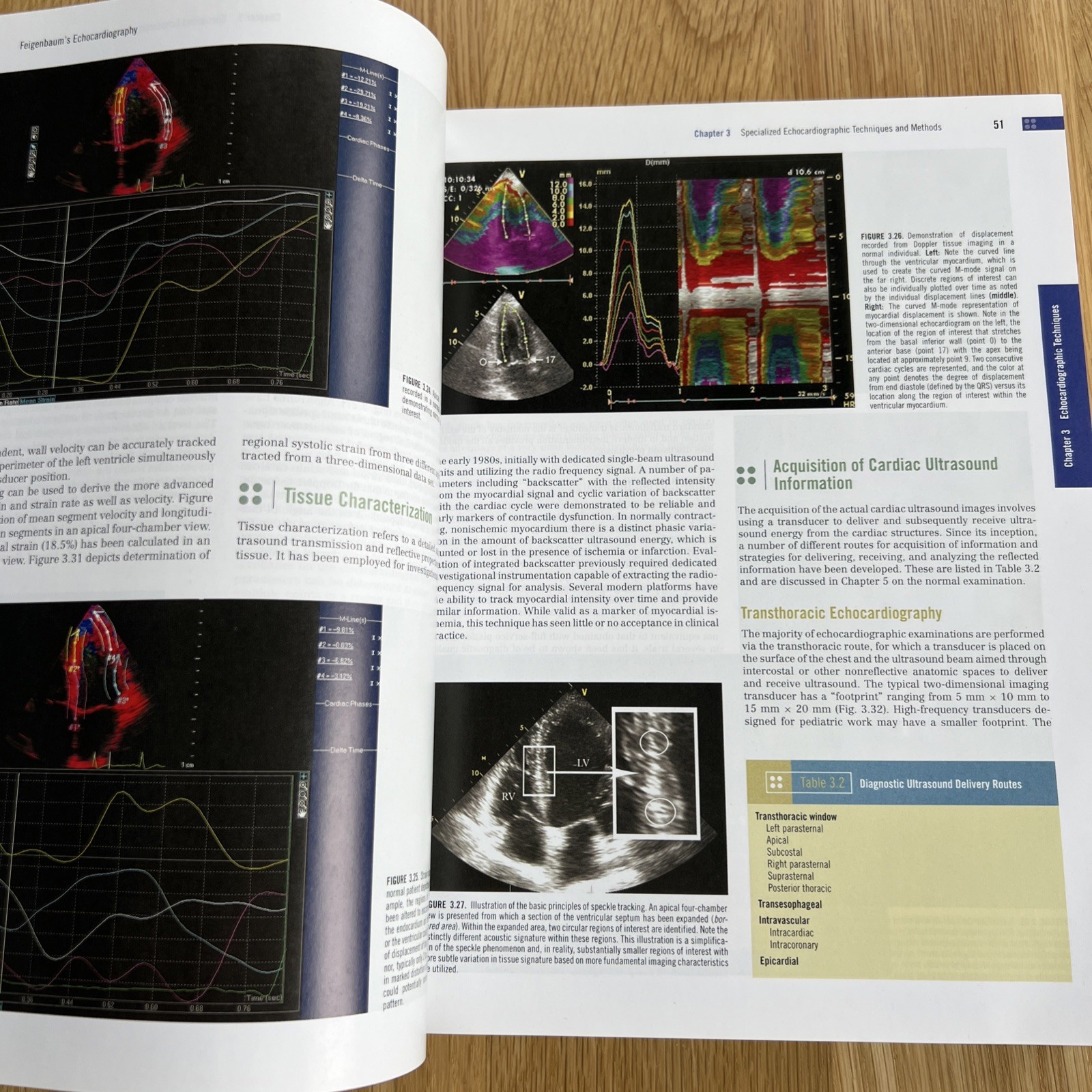 Feigenbaum&rsquo;s Echocardiography by Thomas Ryan and William F. Armstrong (2009,…