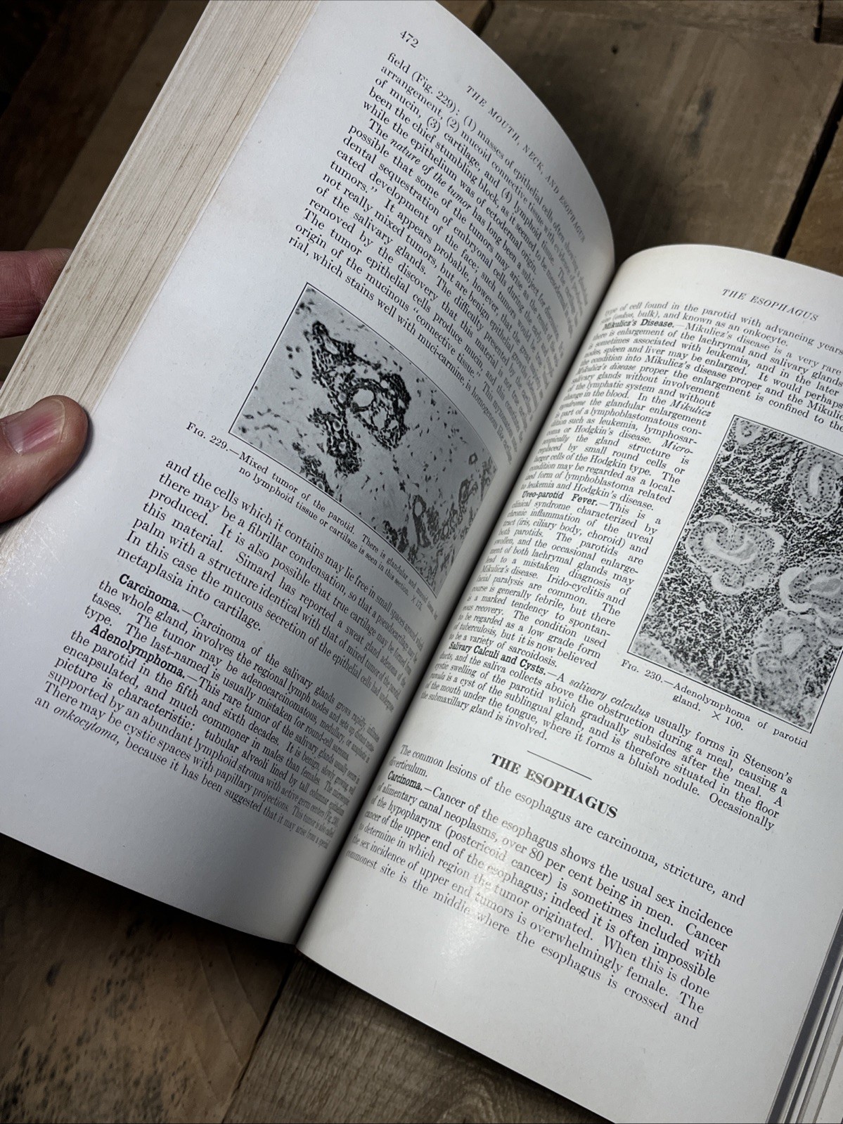 A Textbook Of Pathology by William Boyd Hardcover 1943 4th edition Fourth HBA