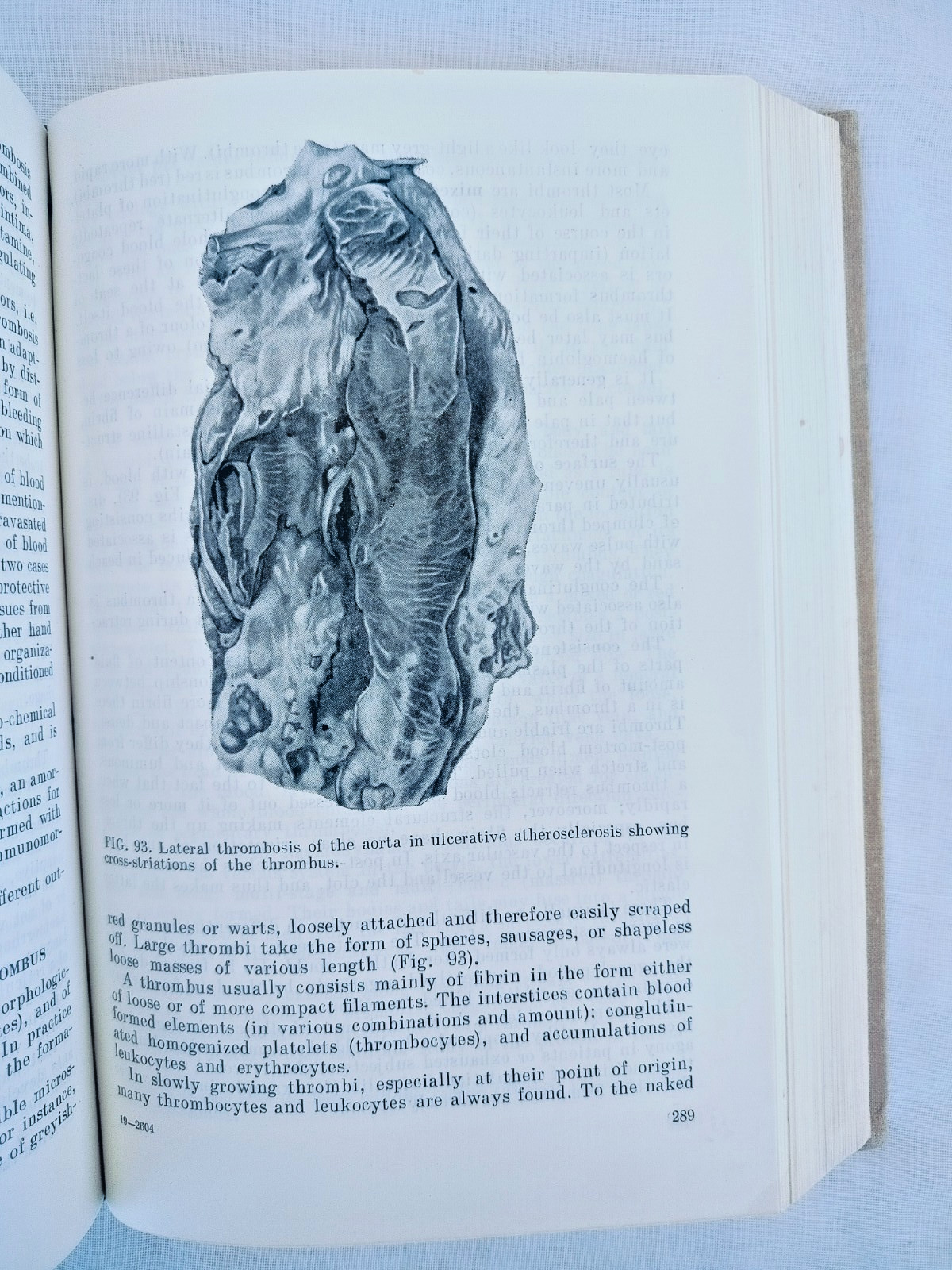 General Human Pathology by Ippolit Davydovsky, Mir Publishers, 1971, Hardcover