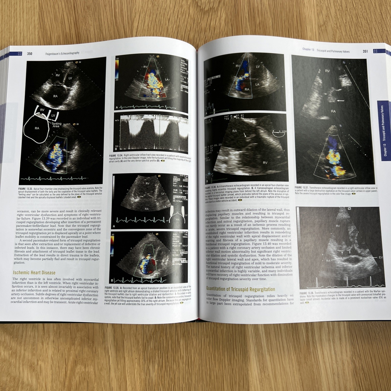 Feigenbaum&rsquo;s Echocardiography by Thomas Ryan and William F. Armstrong (2009,…