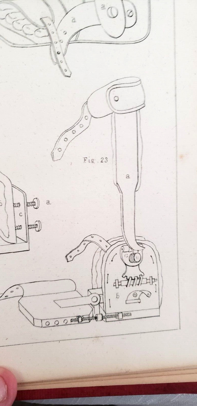 1845 1st,Bigelow MANUAL OF ORTHOPEDIC SURGERY,Harvard Medical Prize, MANY PLATES