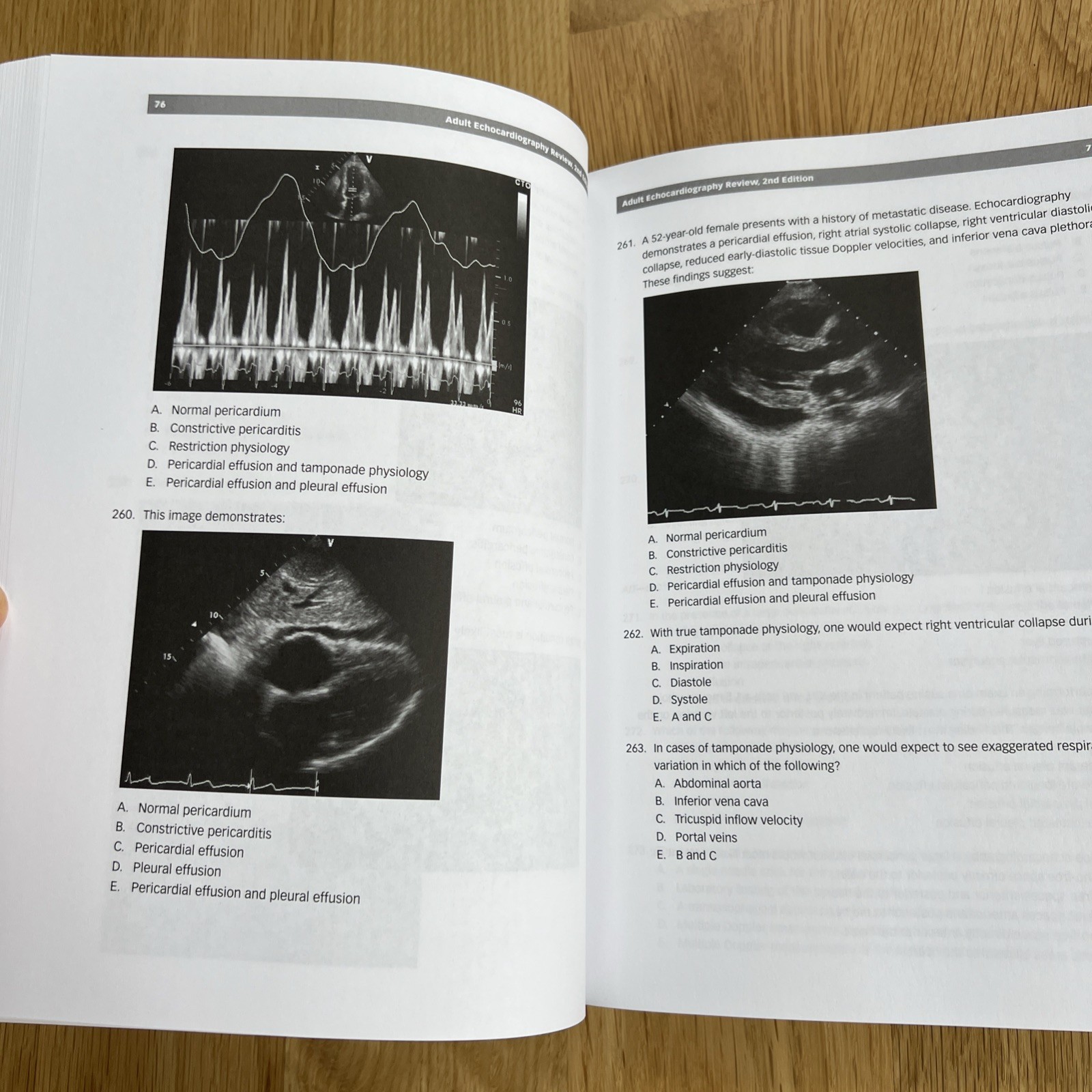 Davies Adult Echocardiography Review by Carol Mitchell and Bridgett Willey