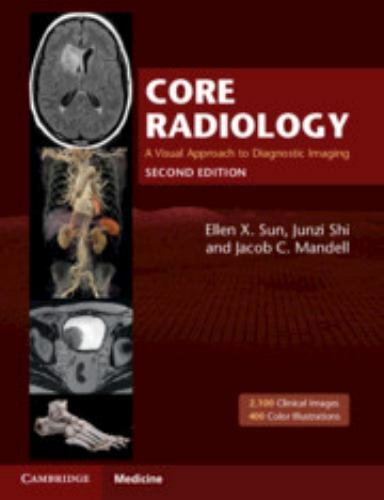 Core Radiology: A Visual Approach to Diagnostic Imaging by Ellen X. Sun