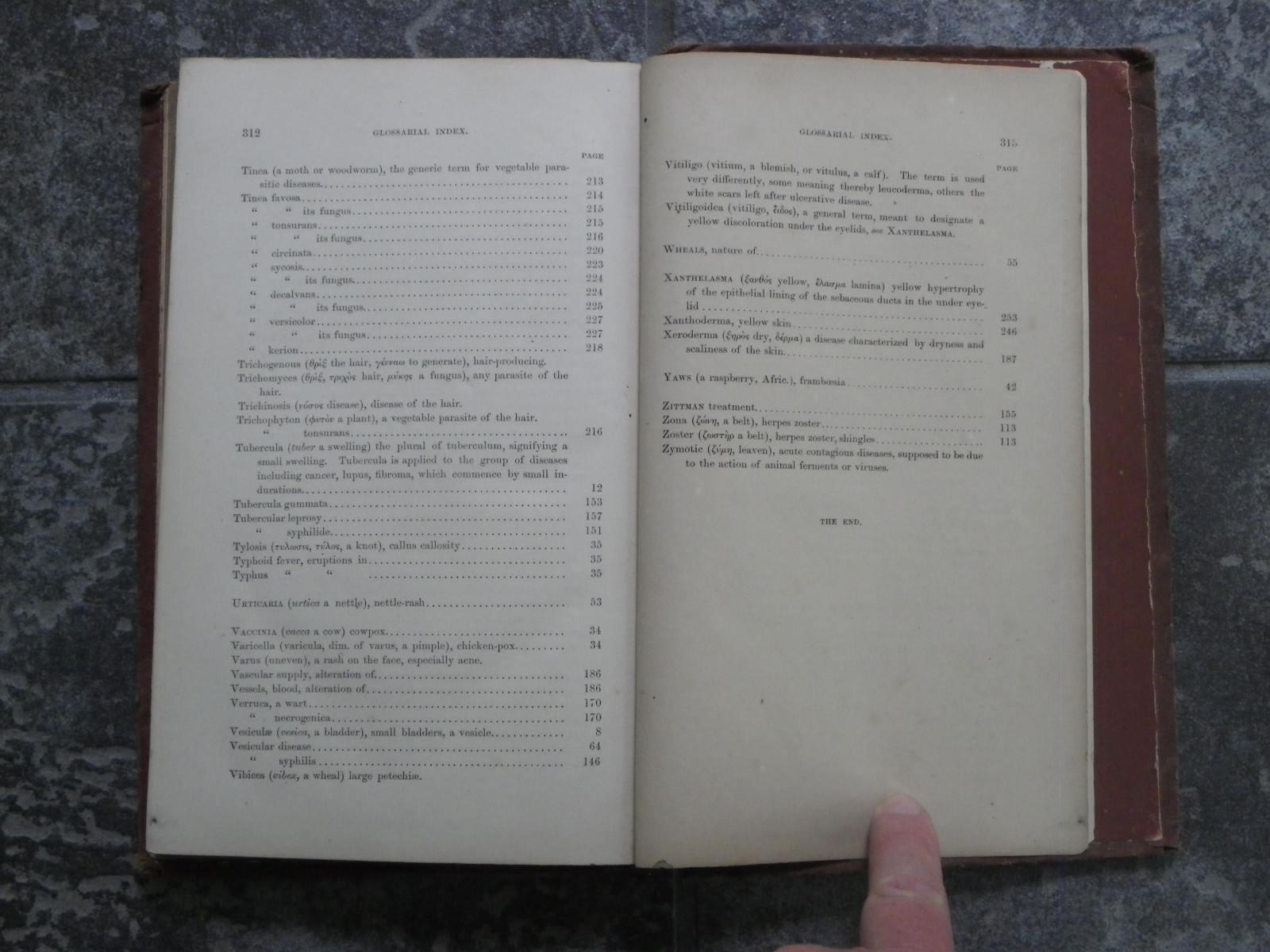 Skin Diseases-Description Pathology Diagnosis Treatment-Fox-1871-1st US Ed-Rare