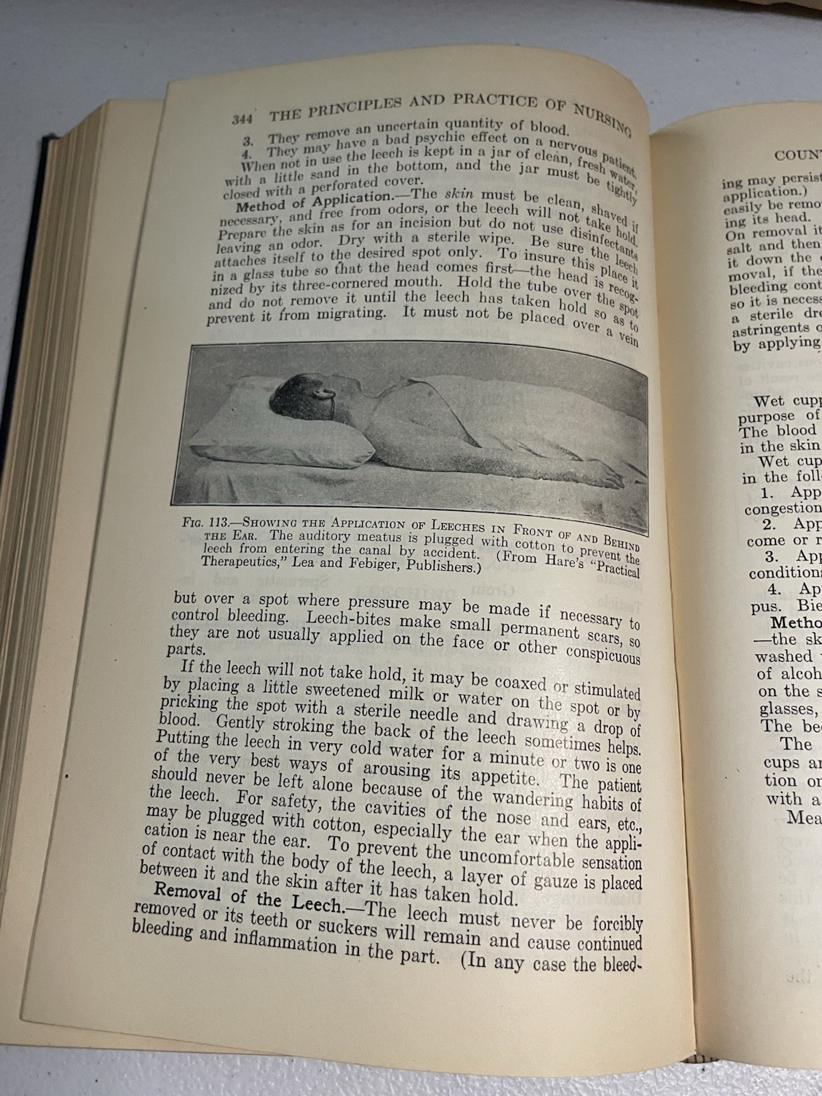 Antique Nursing Textbook The Principles and Practice of Nursing 1926 Inscribed
