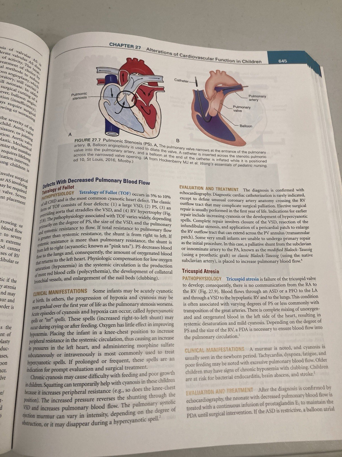 Understanding Pathophysiology by Kathryn L. McCance & Sue E. Huether 7th Edition