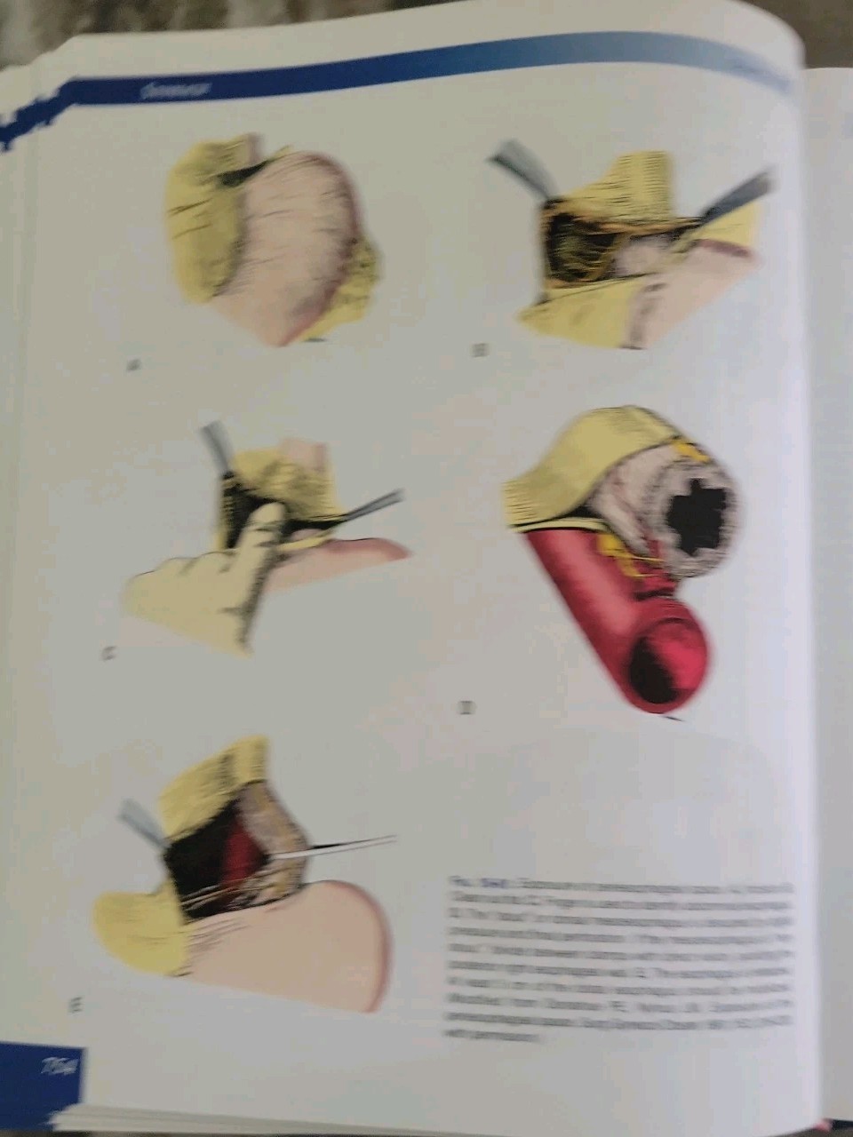 Skandalakis&rsquo; Surgical Anatomy: The Embryologic and Anatomic Basis 1st & 2nd Vol