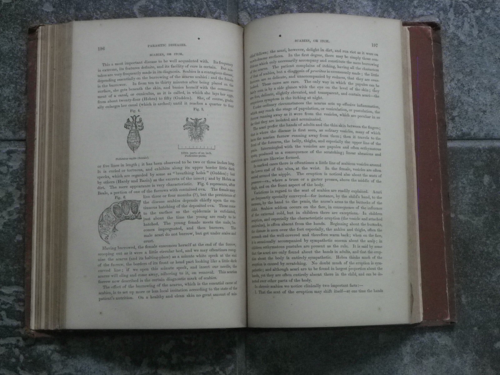 Skin Diseases-Description Pathology Diagnosis Treatment-Fox-1871-1st US Ed-Rare