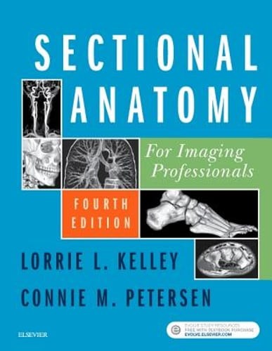 Sectional Anatomy for Imaging Professionals by Rt Kelley, Lorrie L, MS: Used
