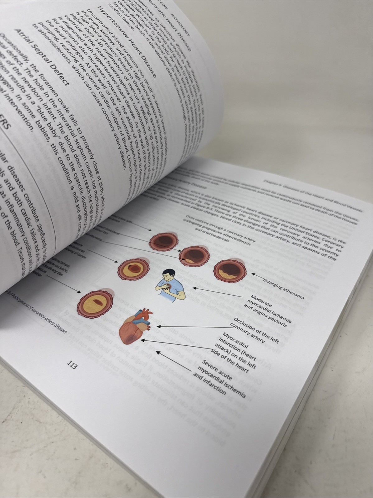 Pathology and Microbiology for Mortuary Science SECOND EDITION *Unused W/ Wear