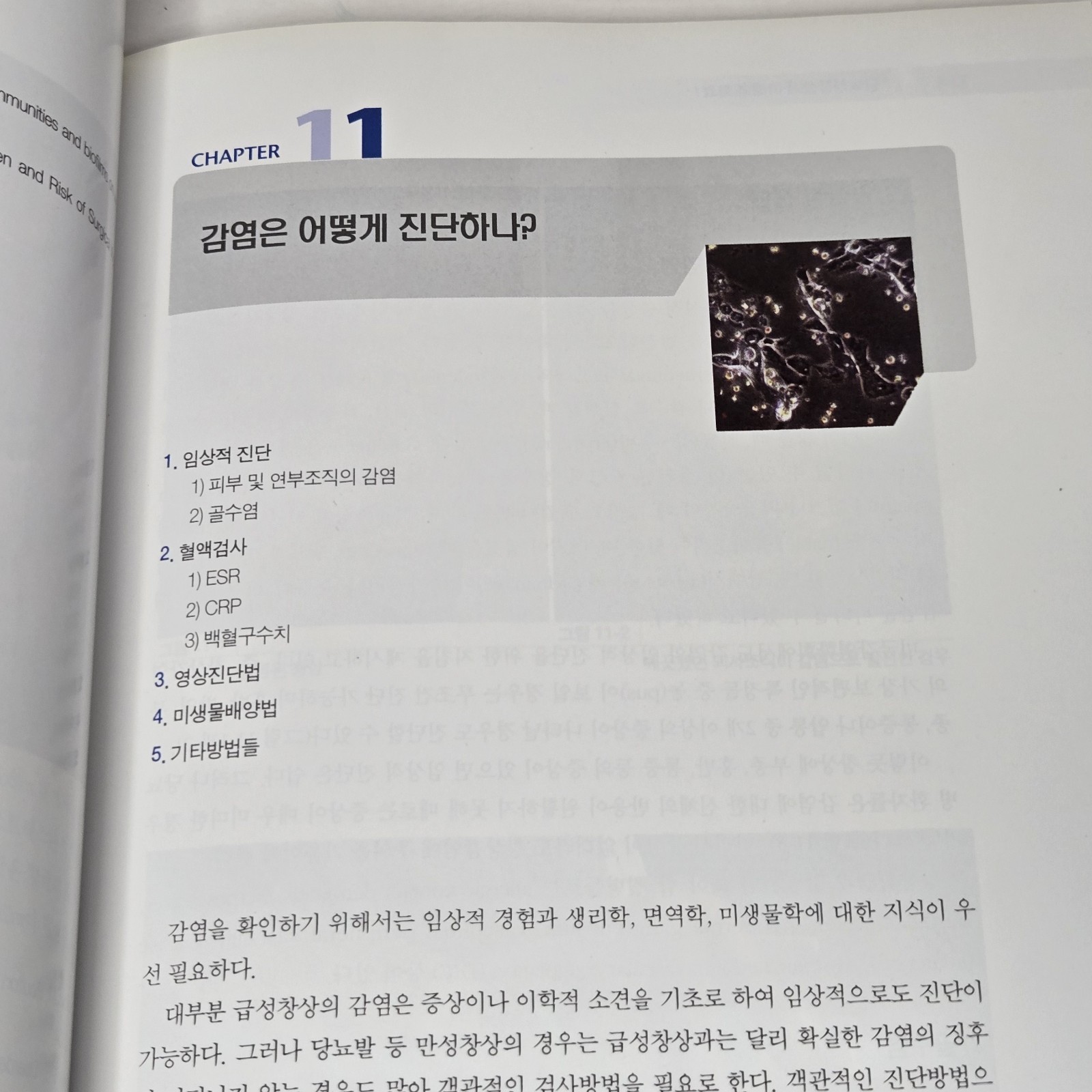 당뇨성 창상의 이해와 치료 (Management of Diabetic Wound) by Han Seung-kyu (한승규) 2008 Korean