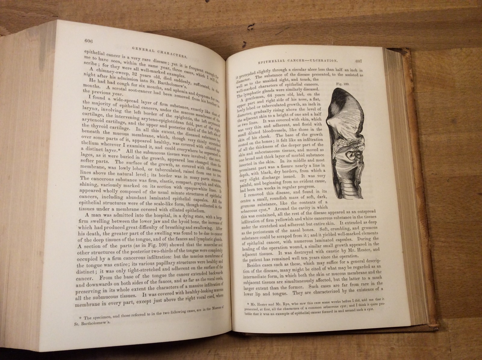 Lectures on Surgical Pathology, James Paget, 1865 Leather Hardcover