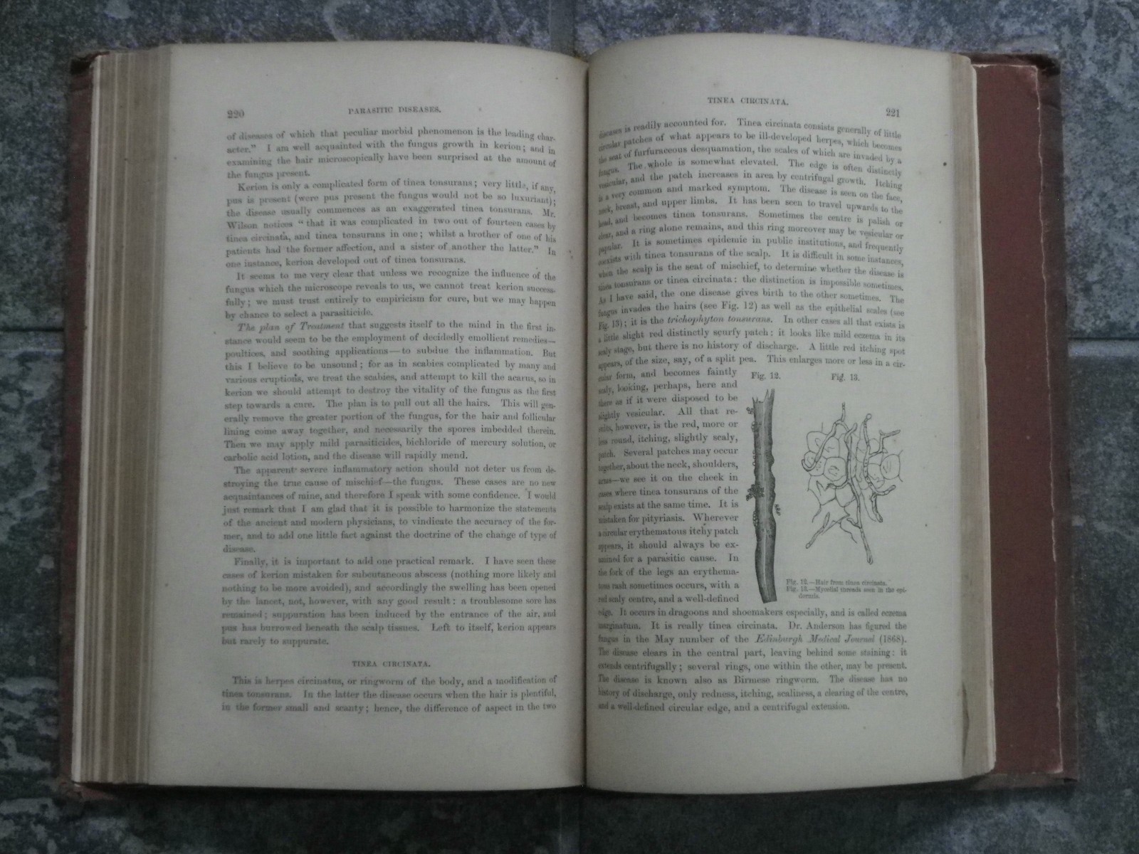 Skin Diseases-Description Pathology Diagnosis Treatment-Fox-1871-1st US Ed-Rare