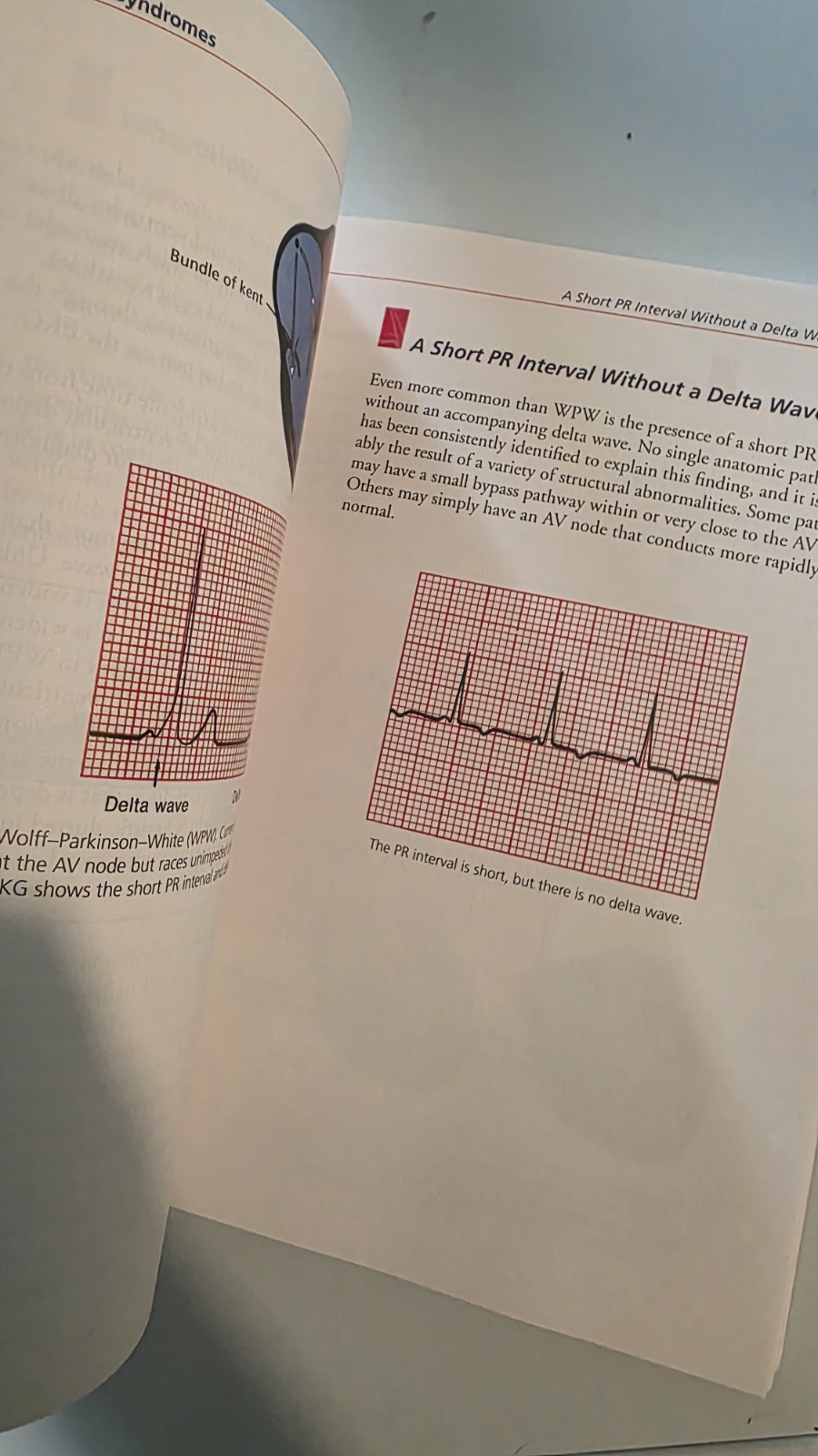 The Only EKG Book You&rsquo;ll Ever Need Ninth Edition