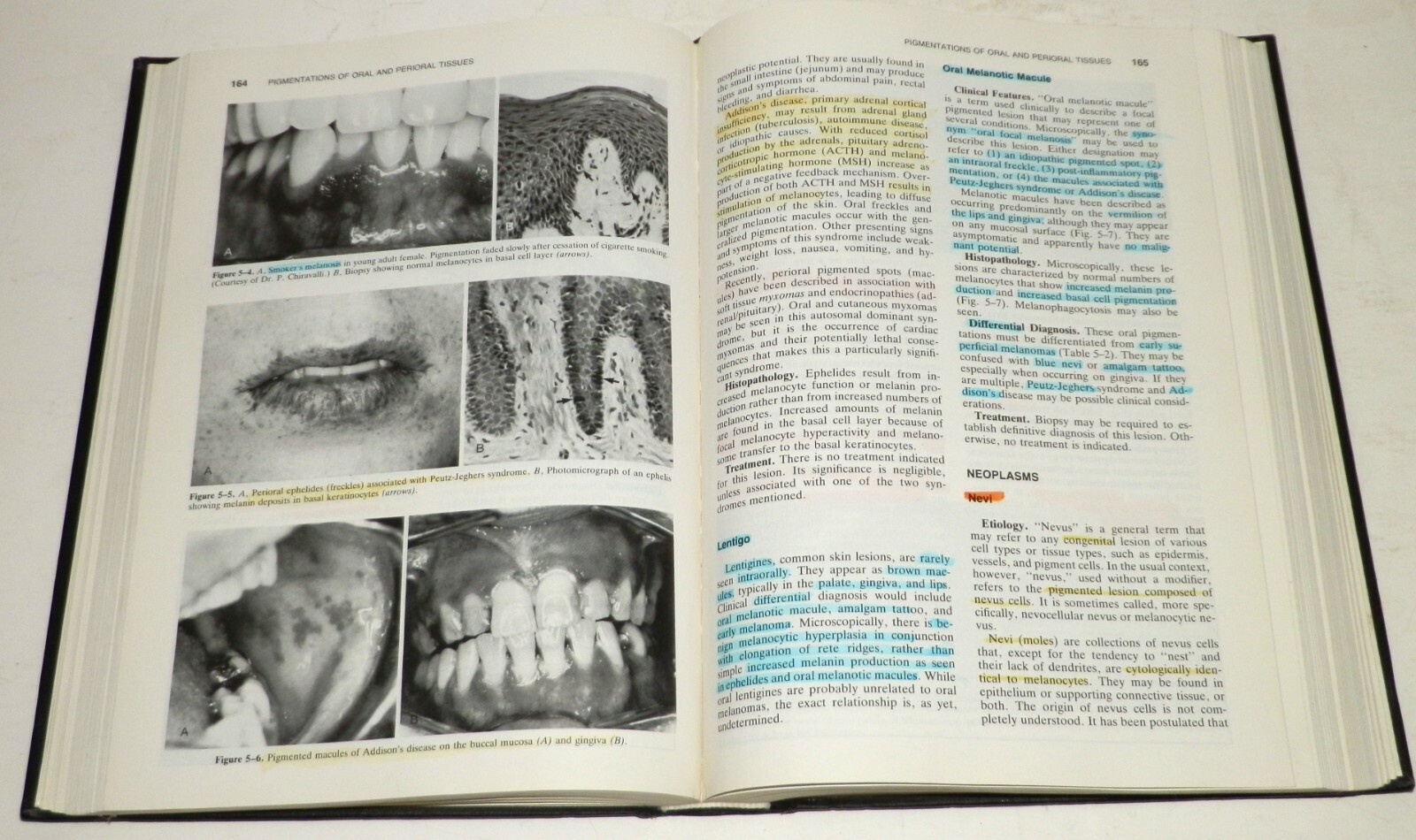 Oral Pathology Clinical Pathologic Correlations Regezi and Sciubba 2nd Edition
