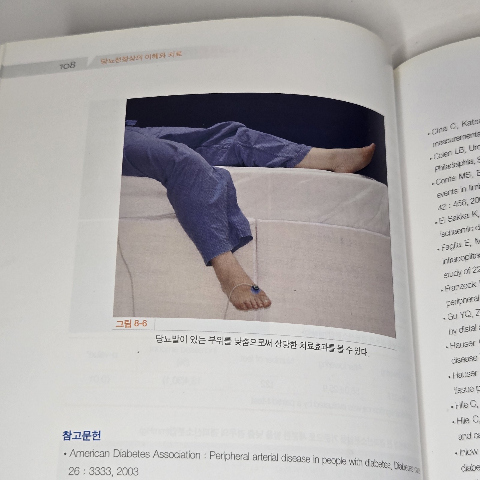 당뇨성 창상의 이해와 치료 (Management of Diabetic Wound) by Han Seung-kyu (한승규) 2008 Korean