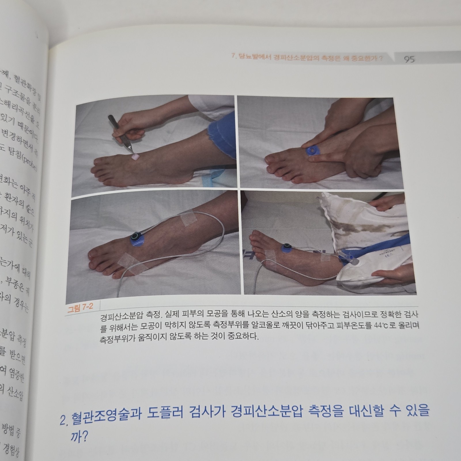 당뇨성 창상의 이해와 치료 (Management of Diabetic Wound) by Han Seung-kyu (한승규) 2008 Korean