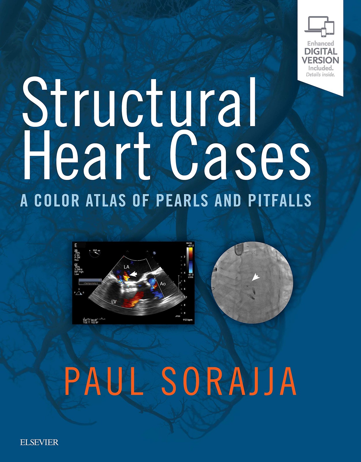 Structural Heart Cases: A Color Atlas of Pearls and Pitfalls [Hardcover] Sorajj