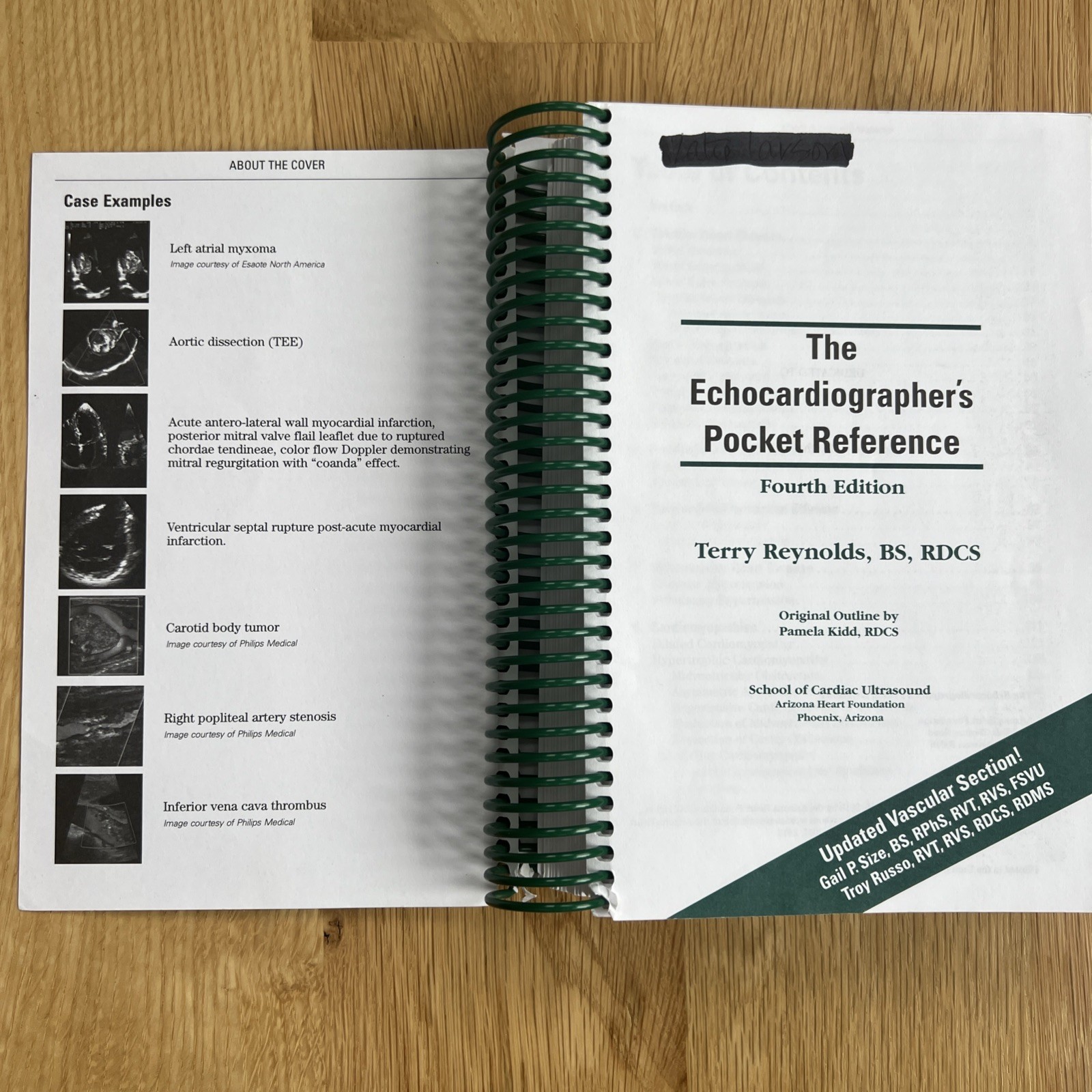 Echocardiographer&rsquo;s Pocket Reference by Terry Reynolds 4th Edition