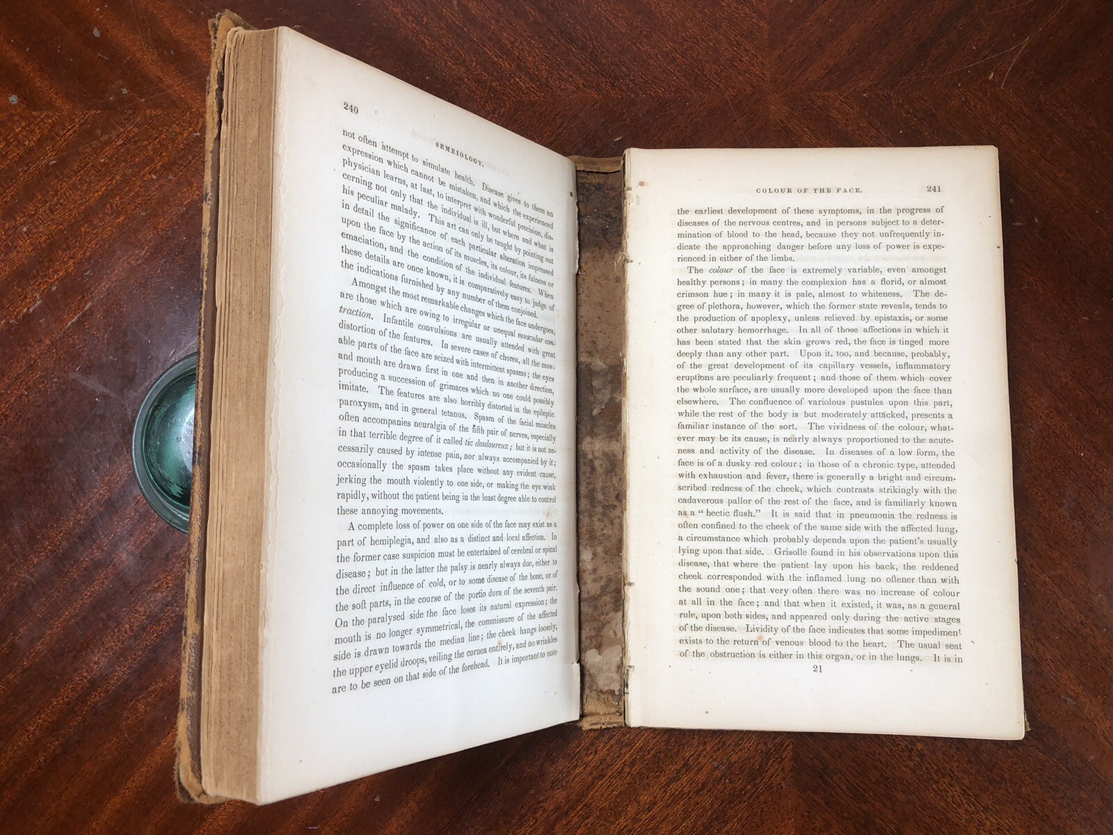 Elements of General Pathology, Alfred Stille 1848 1st Ed. Disease -Split Binding