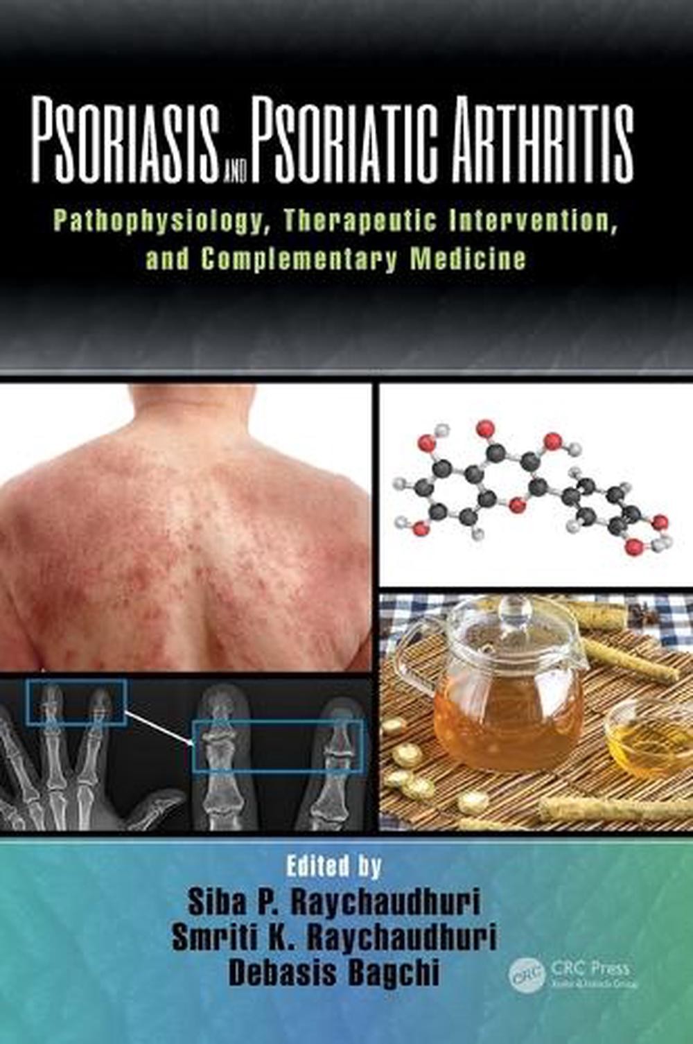 Psoriasis and Psoriatic Arthritis: Pathophysiology, Therapeutic Intervention, an