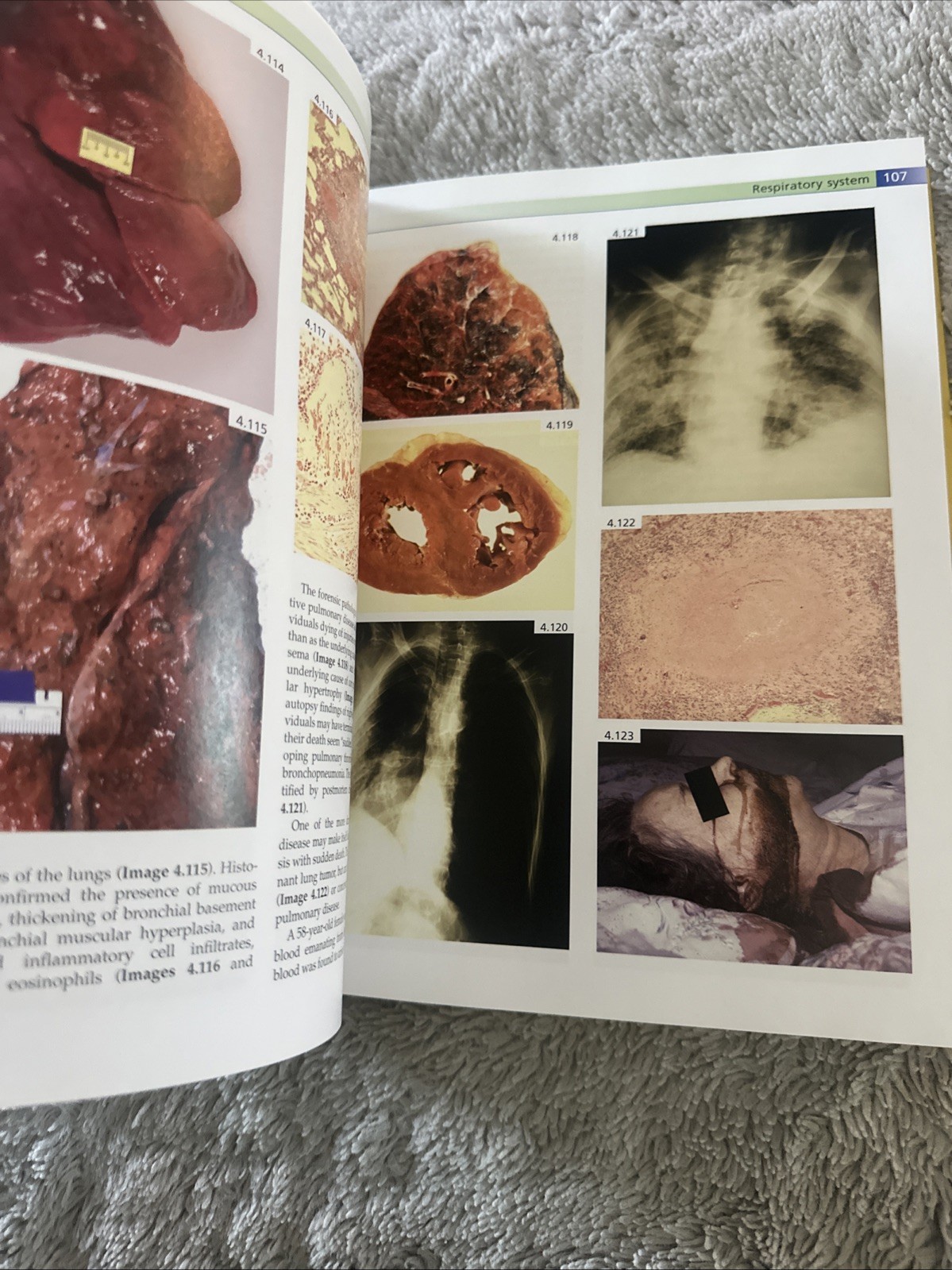 Forensic Pathology Principles and Practice Dolinak Matshes Lew Hardcover HC