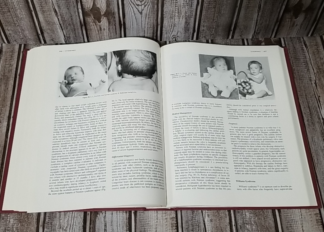 Fetal & Neonatal Cardiology Walker A. Long MD Hardback Hardcover 1990 Ships Fast