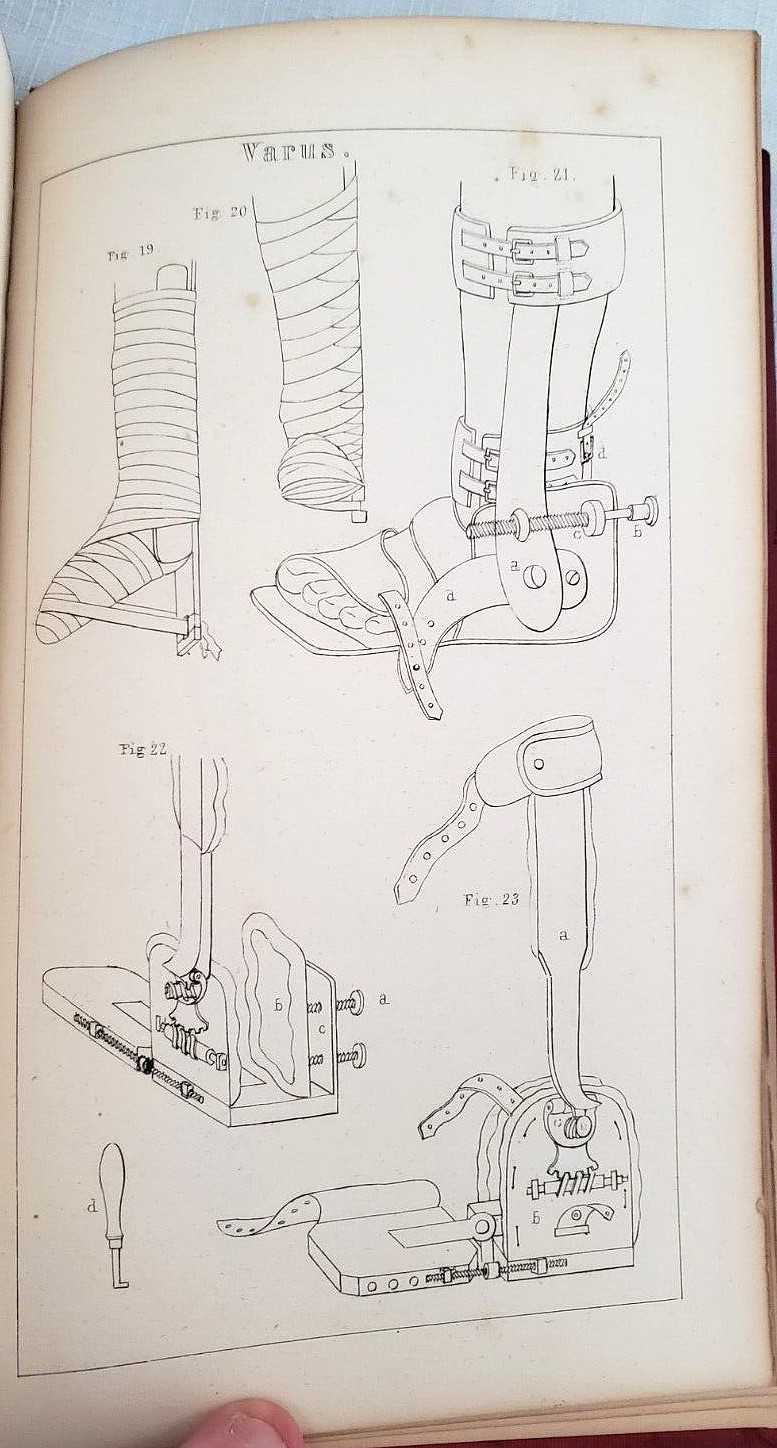 1845 1st,Bigelow MANUAL OF ORTHOPEDIC SURGERY,Harvard Medical Prize, MANY PLATES