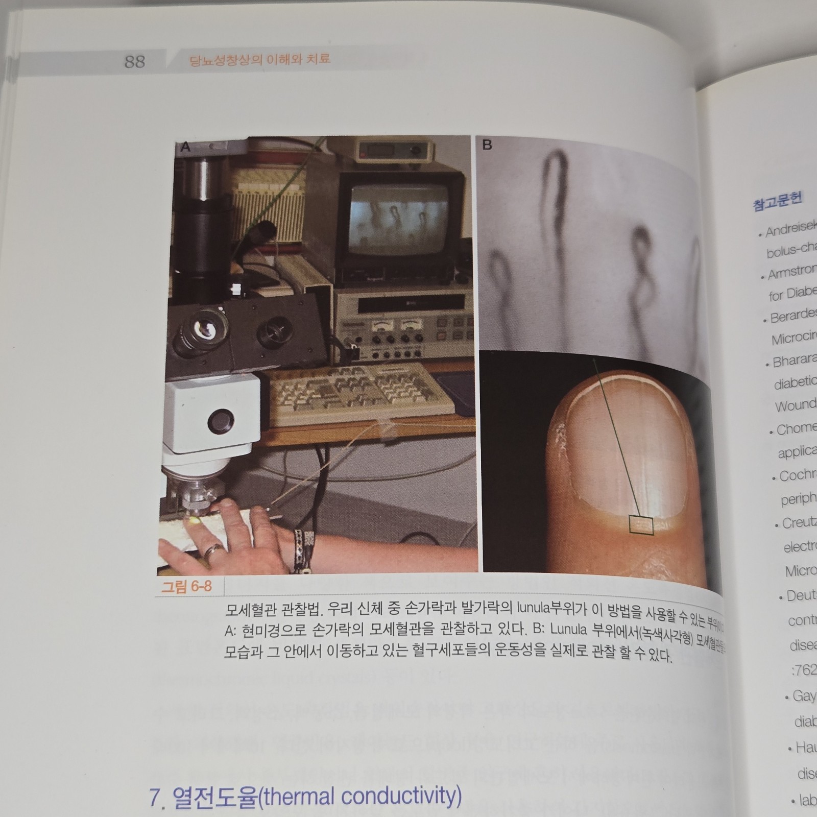 당뇨성 창상의 이해와 치료 (Management of Diabetic Wound) by Han Seung-kyu (한승규) 2008 Korean