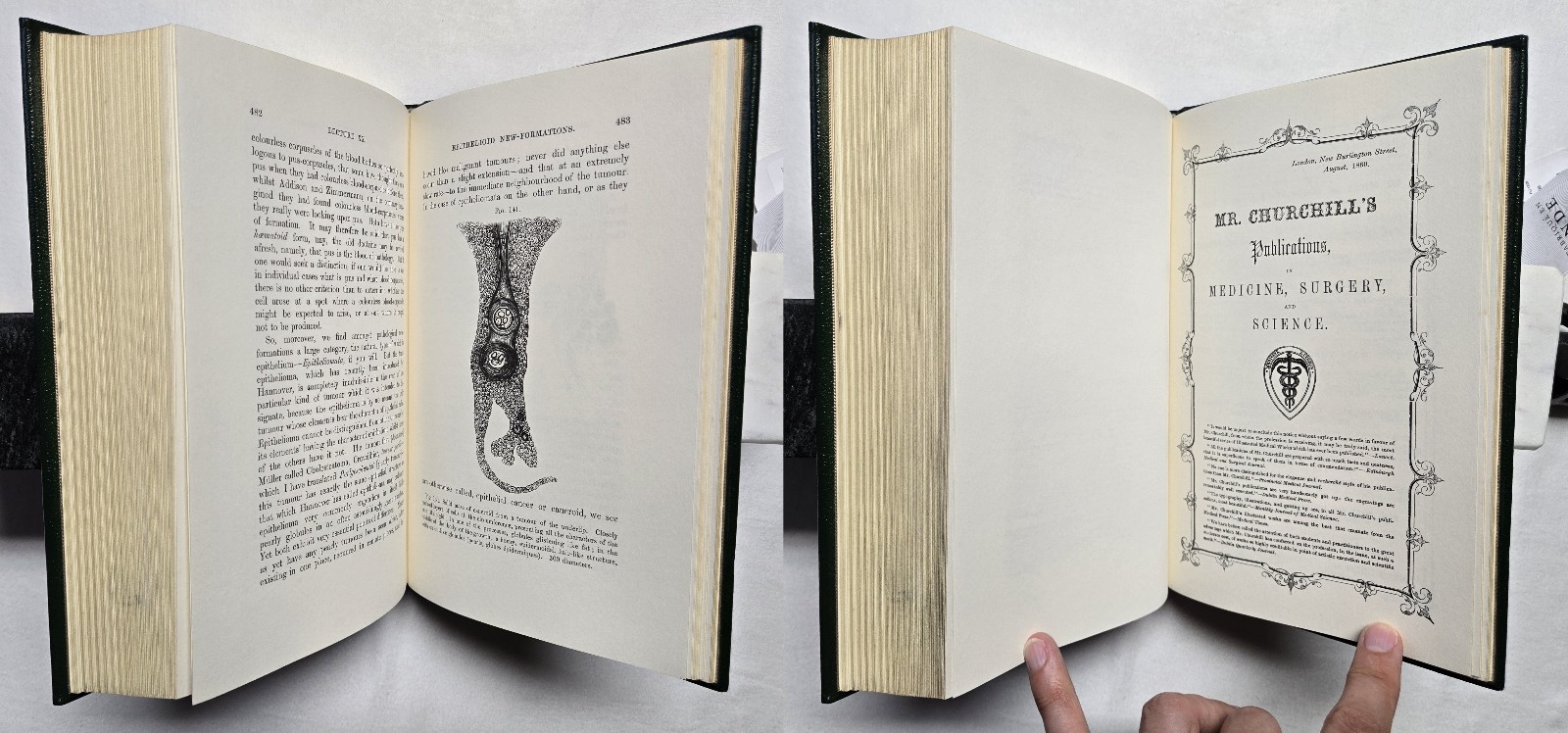 Cellular Pathology by Rudolph Virchow (The Classics of Medicine Library) 1978